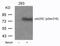 Cell Division Cycle 25C antibody, GTX50689, GeneTex, Western Blot image 
