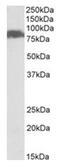 Solute Carrier Family 26 Member 6 antibody, AP32055PU-N, Origene, Western Blot image 