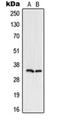 Uracil DNA Glycosylase antibody, orb214719, Biorbyt, Western Blot image 