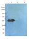 Transforming Growth Factor Beta Receptor 2 antibody, GTX37527, GeneTex, Western Blot image 