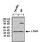 Tex17 antibody, NBP2-22481, Novus Biologicals, Immunoprecipitation image 