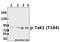 Mitogen-Activated Protein Kinase Kinase Kinase 7 antibody, A01458T184, Boster Biological Technology, Western Blot image 