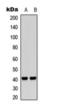 F2R Like Thrombin Or Trypsin Receptor 3 antibody, orb393281, Biorbyt, Western Blot image 