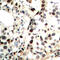 Checkpoint Kinase 2 antibody, abx133175, Abbexa, Western Blot image 