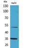 Tissue Factor Pathway Inhibitor antibody, STJ96600, St John