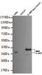 Interleukin 18 Binding Protein antibody, M07261, Boster Biological Technology, Western Blot image 