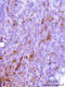 Cyclin Dependent Kinase 2 antibody, M00166-4, Boster Biological Technology, Immunohistochemistry paraffin image 