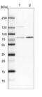 Protein O-Mannosyltransferase 2 antibody, NBP1-86152, Novus Biologicals, Western Blot image 