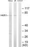 Zinc Finger Protein 875 antibody, EKC1674, Boster Biological Technology, Western Blot image 