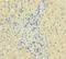 Serpin B3 antibody, A55751-100, Epigentek, Immunohistochemistry paraffin image 