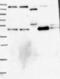 Tripeptidyl Peptidase 1 antibody, NBP1-85561, Novus Biologicals, Western Blot image 