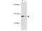 MDM2 Binding Protein antibody, M08842, Boster Biological Technology, Western Blot image 