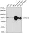 ATPase H+ Transporting V1 Subunit A antibody, 15-677, ProSci, Western Blot image 