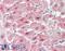 Protein Kinase C Beta antibody, 43-319, ProSci, Immunohistochemistry paraffin image 