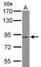 Protein Kinase C Alpha antibody, GTX111096, GeneTex, Western Blot image 