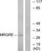 MAS Related GPR Family Member E antibody, A30837, Boster Biological Technology, Western Blot image 