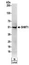 Serine Hydroxymethyltransferase 1 antibody, NBP2-32173, Novus Biologicals, Western Blot image 