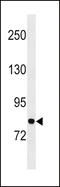 Glycyl-TRNA Synthetase antibody, LS-B9126, Lifespan Biosciences, Western Blot image 