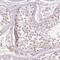 Tudor Domain Containing 15 antibody, NBP2-49019, Novus Biologicals, Immunohistochemistry paraffin image 