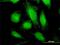 Tryptophanyl-TRNA Synthetase antibody, H00007453-M02, Novus Biologicals, Immunofluorescence image 