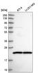SCAN Domain Containing 1 antibody, HPA047138, Atlas Antibodies, Western Blot image 