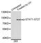 Signal Transducer And Activator Of Transcription 1 antibody, MBS128281, MyBioSource, Western Blot image 