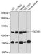 Solute Carrier Family 4 Member 5 antibody, A07878, Boster Biological Technology, Western Blot image 