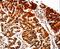 Aldose reductase antibody, LS-C403714, Lifespan Biosciences, Immunohistochemistry paraffin image 