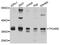 Toll Like Receptor Adaptor Molecule 2 antibody, MBS9128604, MyBioSource, Western Blot image 