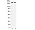 Reticulon 4 antibody, R30241, NSJ Bioreagents, Western Blot image 