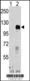 EPH Receptor B4 antibody, 63-061, ProSci, Western Blot image 
