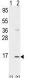 Pro-Platelet Basic Protein antibody, abx033474, Abbexa, Western Blot image 