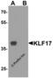 Kruppel Like Factor 17 antibody, 8041, ProSci, Western Blot image 