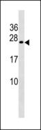 ER Membrane Protein Complex Subunit 8 antibody, PA5-49300, Invitrogen Antibodies, Western Blot image 