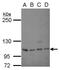 Sp1 Transcription Factor antibody, GTX100671, GeneTex, Western Blot image 