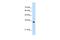 Apolipoprotein B MRNA Editing Enzyme Catalytic Subunit 3D antibody, PA5-41950, Invitrogen Antibodies, Western Blot image 