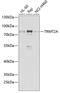 TRNA Methyltransferase 2 Homolog A antibody, 22-693, ProSci, Western Blot image 