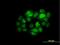 Interferon Regulatory Factor 5 antibody, H00003663-M03, Novus Biologicals, Immunocytochemistry image 