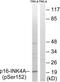 Cyclin-dependent kinase inhibitor 2A antibody, LS-C199368, Lifespan Biosciences, Western Blot image 