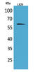 Interleukin 2 Receptor Subunit Beta antibody, STJ96629, St John