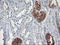 Glucosylceramidase Beta 3 (Gene/Pseudogene) antibody, LS-C172747, Lifespan Biosciences, Immunohistochemistry frozen image 