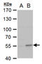 Collagen Type I Alpha 2 Chain antibody, TA308423, Origene, Western Blot image 