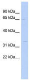 Sterol-C5-Desaturase antibody, TA336055, Origene, Western Blot image 