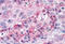 Serum/Glucocorticoid Regulated Kinase Family Member 3 antibody, MBS242801, MyBioSource, Immunohistochemistry frozen image 