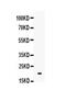 Triggering Receptor Expressed On Myeloid Cells Like 1 antibody, PA5-80185, Invitrogen Antibodies, Western Blot image 