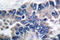 Signal Transducer And Activator Of Transcription 2 antibody, LS-C176217, Lifespan Biosciences, Immunohistochemistry paraffin image 