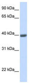 MAGE Family Member A1 antibody, TA339275, Origene, Western Blot image 