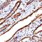 Cathepsin L antibody, PA5-47971, Invitrogen Antibodies, Immunohistochemistry paraffin image 