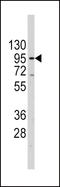 Telomerase Reverse Transcriptase antibody, LS-B11086, Lifespan Biosciences, Western Blot image 