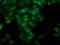 Pleckstrin Homology Domain Containing A3 antibody, LS-C172960, Lifespan Biosciences, Immunofluorescence image 